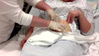 Colostomy Care Teaching Video [upl. by Blayne4]