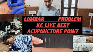 Back pain treatment disc problem treatment  acupuncture  Acupressure [upl. by Urbas]