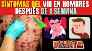 Síntomas del VIH en hombres después de 1 semana [upl. by Frantz790]