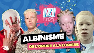 ALBINISME  FAIRE DE SA DIFFÉRENCE SA FORCE • IZI NEWS [upl. by Hindu233]