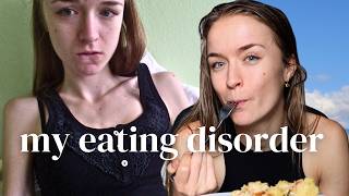 MY 6 YEAR EATING DISORDER RECOVERY STORY  Anorexia and Orthorexia Journey [upl. by Lund]