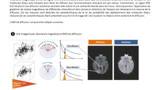 IRM diffusion [upl. by Gordan]