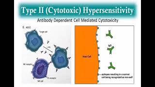 10 Hypersensitivity reactions Type 2  3 and 4 Hypersensitivity reactions شرح بالعربي [upl. by Sang]