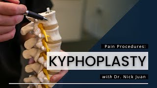 Kyphoplasty What You Need To Know [upl. by Edualcnaej242]