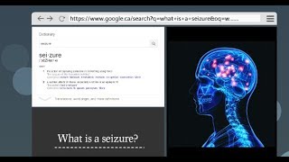 What Are Seizures and How to Recognize Them [upl. by Brynna]