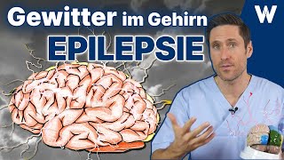 Epileptischer Anfall gefährlich amp was tun Ursachen einer Epilepsie amp erste Hilfe beim Krampfanfall [upl. by Rebak]