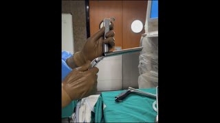 MLS microlaryngoscopy procedure [upl. by Silyhp497]