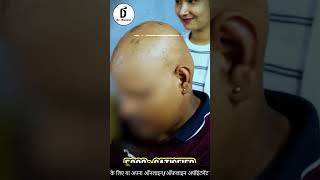 ALOPECIA AREATA amp Hair fall How to prevent PATCHY HAIR LOSS  Dr Bansal  ganjapan [upl. by Atnim564]