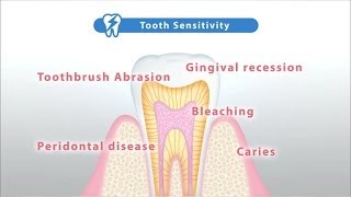 Relieve tooth sensitivity with Teethmate Desensitizer Creating Hydroxyapatite HAp [upl. by Adamo]