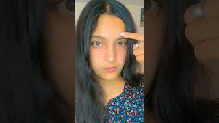 yai bin bulay pimple pimples sad viralvideo [upl. by Laflam]