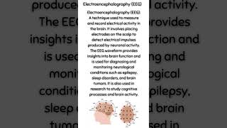 Electroencephalography EEG [upl. by Malliw135]