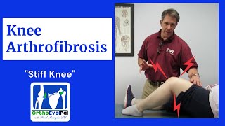 How to Treat an Arthrofibrotic Knee in Physical Therapy [upl. by Ahsel]