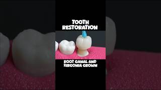 Tooth Restoration  Root Canal  Zirconia Crown ©️ CTTO RelaxingVideos satisfyingvideos [upl. by Bautista]