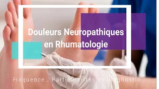 Douleurs neuropathiques en rhumatologie Fréquence particularités et Diagnostic [upl. by Izmar]