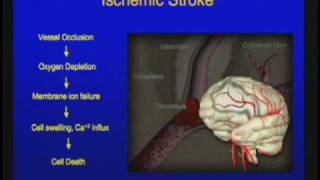 Vascular Disorders of the Central Nervous System [upl. by Wooster]