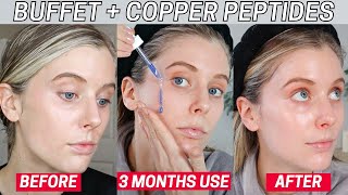 I Used a Full Bottle of The Ordinary Buffet  Copper Peptides 1 Copper Peptides Skin Results [upl. by Nnayrb]