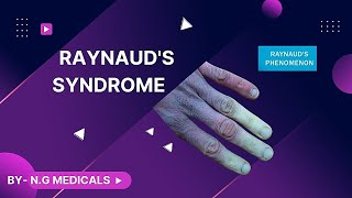 Raynauds Disease  WITH EASY NOTES FULL EXPLANATION IN HINDI BY NG MEDICALS [upl. by Drehcir]