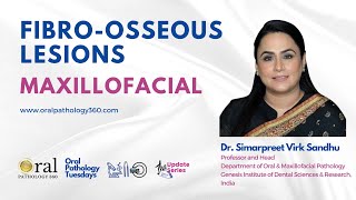 Maxillofacial Fibroosseous Lesions Oral Pathology360 Updates [upl. by Eednyl]