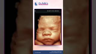 Expert Fetal Diagnosis And Growth Monitoring At Dr Aditis Fetal Medicine Centre Prayagraj [upl. by Erlin]