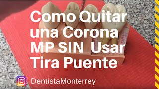 ✅La Mejor Forma de Quitar una Corona MP👅SIN usar Tira Puente [upl. by Hyacinthia]