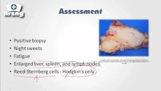 Lymphoma NCLEX® Review  NRSNGacademycom [upl. by Ariday]