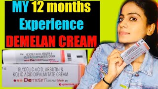 MY 12 MONTHS EXPERIENCE WITH DEMELAN CREAM  DEMELAN CREAM  DEMELAN  DEMELAN CREAM REVIEW  HEENA [upl. by Erihppas813]