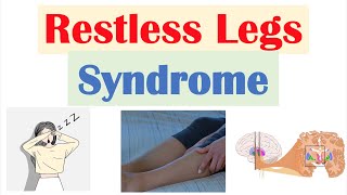 Restless Legs Syndrome RLS  Causes Signs amp Symptoms Diagnosis Treatment [upl. by Lenej]