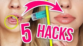 LIPPEN SELBER AUFSPRITZEN 😱 5 HACKS für volle LIPPEN die jeder zu Hause nachmachen kann [upl. by Coucher]