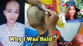 My Head Shave Story 😭  Why I was bald  wonder trisha [upl. by Rodrique399]