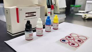 How to do WIDAL Test  Benifits of WIDAL tests  Test for Typhoid widaltest labtest [upl. by Gorrian]