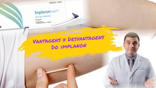 Vantagens e desvantagens do IMPLANON [upl. by Aniretak]