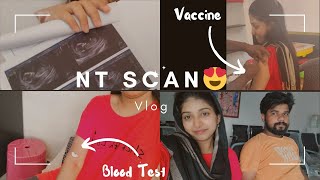 NT SCAN VLOG  Day In My Life  Tamilmallucouple [upl. by Luckin]