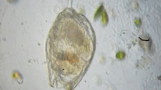 Rotifer  Lecane hamata [upl. by Ayekam]