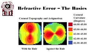 Basics of Astigmatism [upl. by Laro728]