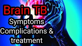 Brain TB Symptoms Complications amp treatment Tuberculosis meningitis Colours of life [upl. by Marv]