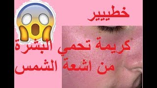 ☀☀☀وجهي ايتحرقلي بالشمس😲😲😲 [upl. by Rowley]