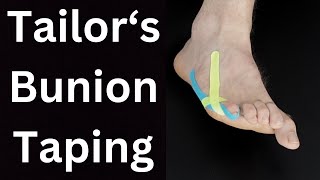 Tailors Bunion Pain Relief Taping [upl. by Drageruaeb]