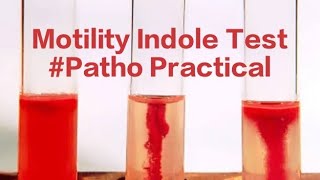 Motility Indole Patho Bacterial Motility Indole test [upl. by Nilyahs]