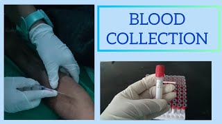 EASY WAY TO DRAW BLOOD।। BLOOD SAMPLE PROCEDURE ।। HOW TO TAKE BLOOD FROM VEIN ।। [upl. by Hecker131]