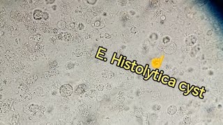 Entamoeba Histolytica trophozoite cyst Stool examination stoolanalysis gse stooltest [upl. by Heddie]