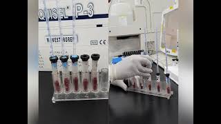 Erythrocyte Sedimentation Rate ESR [upl. by Uah320]