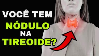 7 SINAIS PERIGOSOS de um NÓDULO na TIREOIDE Sintomas de Câncer na Tireoide [upl. by Kam416]