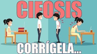 Corrige la CIFOSIS en 3 pasos  Higiene Postural [upl. by Reld]