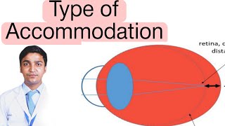 Types of Accommodation  accommodation eye mars group optometry [upl. by Gio]