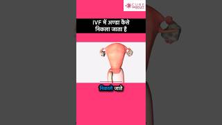 Ovum pick up in IVF  Egg pick up in IVF  IVF procedure shorts [upl. by Cutler401]