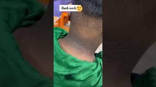 🤯Neck Cleaning Tips Get Rid of Dark NeckDark Neck Home Remedies💯😍shortsytshortsviralskincare [upl. by Jung]