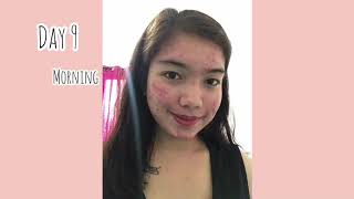 SKINCAREBRILLIANT SET 15 days of using BRILLANT SKIN REJUVENATING SET honest Review [upl. by Aara75]