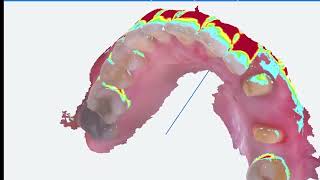 E2 Fussen IntraOral Scanner S6000 Tools [upl. by Flaherty994]