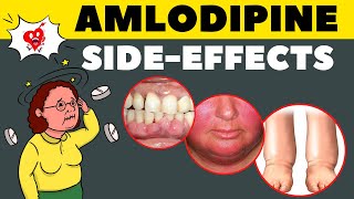 Amlodipine Side Effects amp How to Avoid  Amlodipine Adverse Effects [upl. by Ardnalahs]