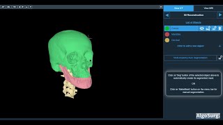 AIbased segmentation and 3D modelling for Maxillofacial Surgical Applications [upl. by Gnad342]